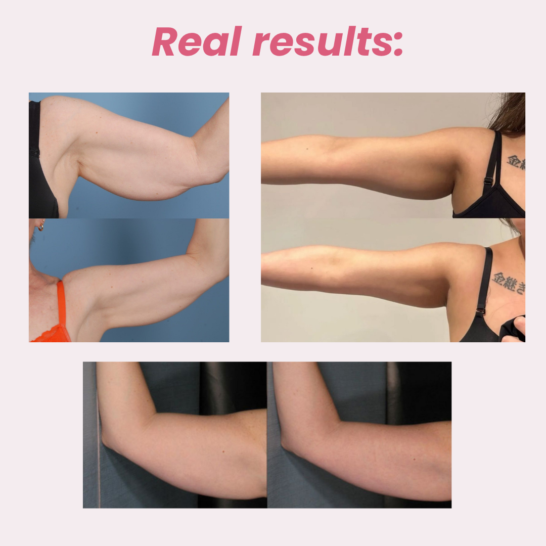The Wellnessie™  Red Light Therapy Arm Sculpt