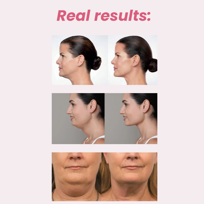 The Wellnessie™ Red light Therapy Neck Sculpt